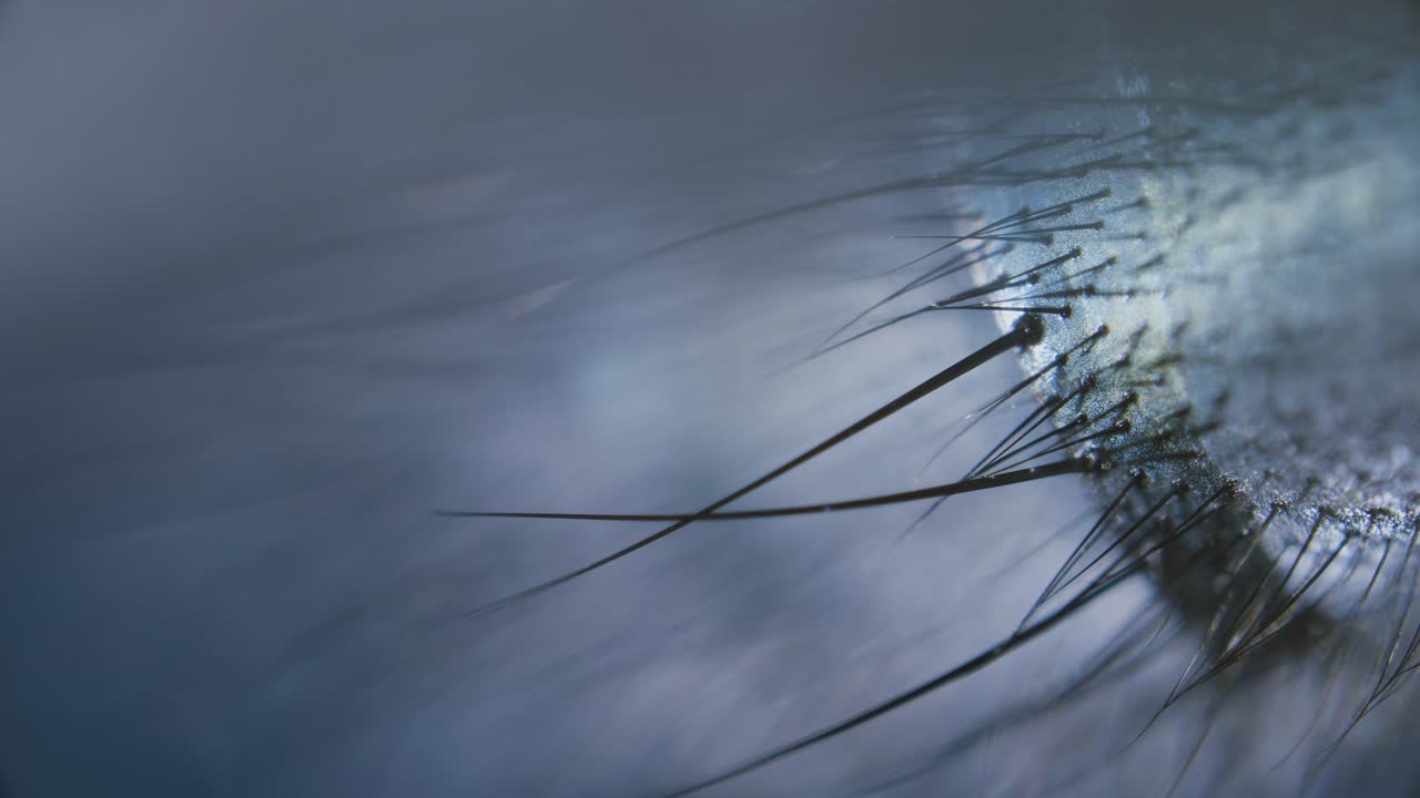 A part of housefly hairy body under microscope
