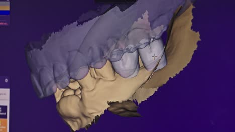 modelo 3d de dientes en la pantalla de la computadora dental