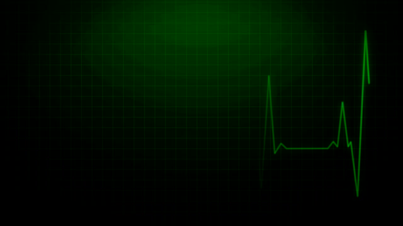 el latido cardíaco del ekg en el monitor de grabación del pulso verde de la atención médica animado 4k imágenes renderizadas.