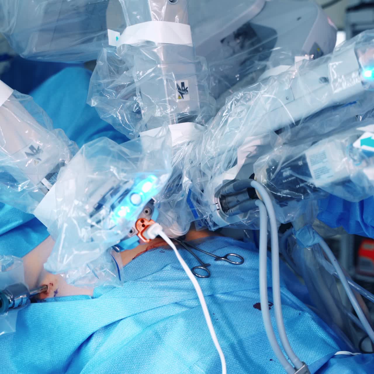 Robotic arms perform an operation. Modern medical equipment doing a complicated microsurgery in clinic. Close-up.