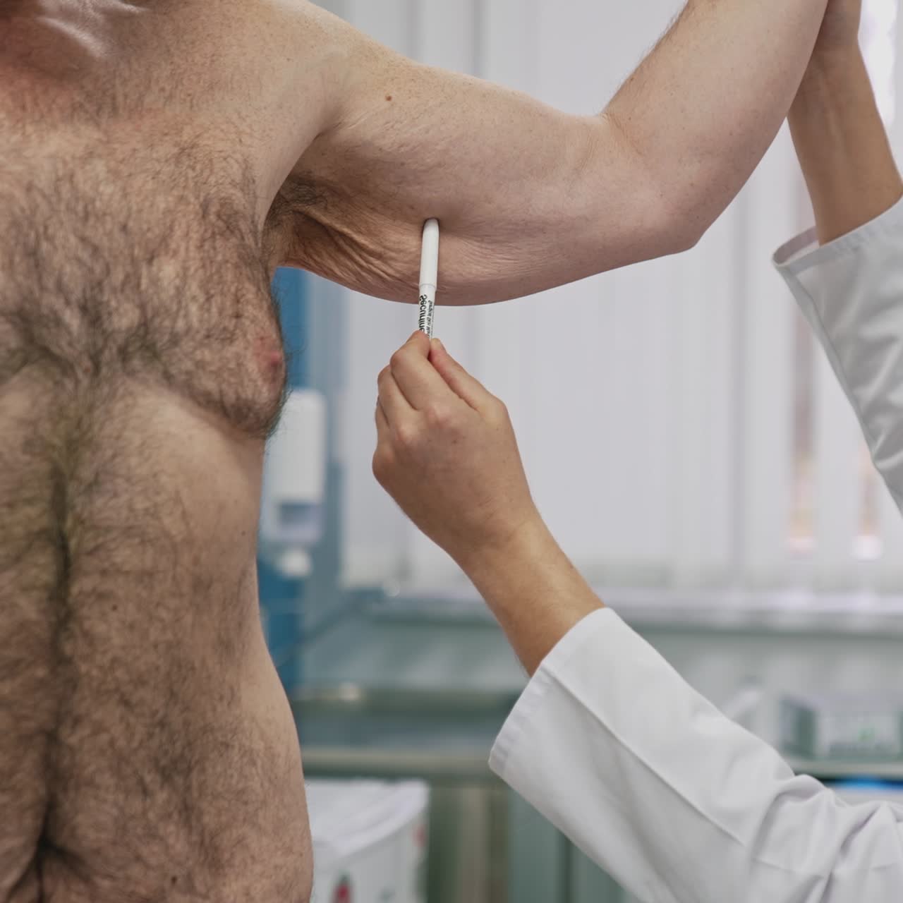 Professional surgeon examines man's body before plastic surgery. Doctor shows the problem parts on a patient's arm and talking on camera