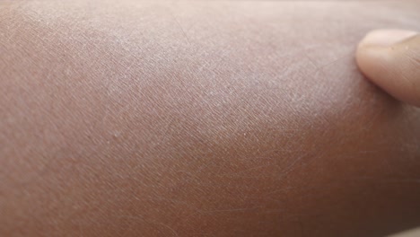 dry skin on arm with finger touching