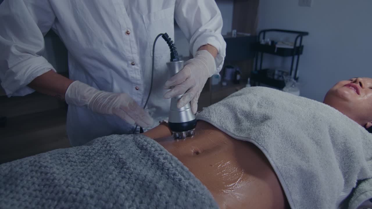 RF Treatment for Body Contouring