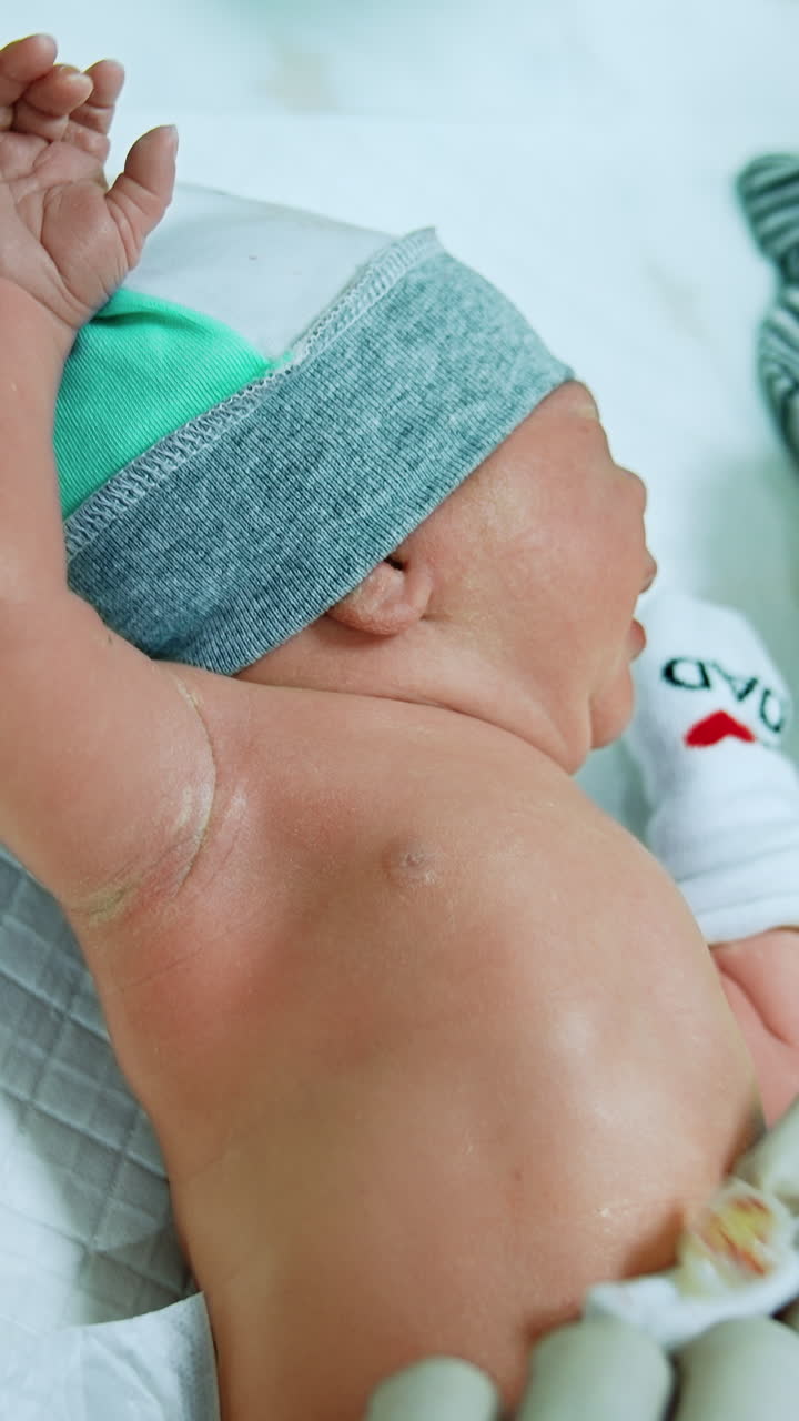 Lovely newborn baby being dressed. Child lies on the table while nurse in gloves puts mittens on tiny hands and other nurse takes care of navel. Vertical video