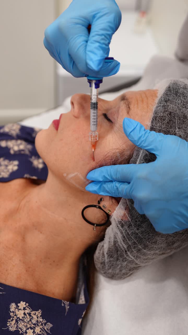 Procedura di iniezione di filler dermici
