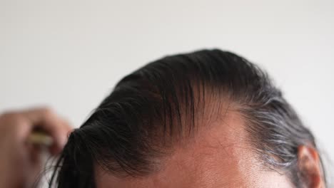 hombre usando pincel en la cabeza con calvicie, cepillado