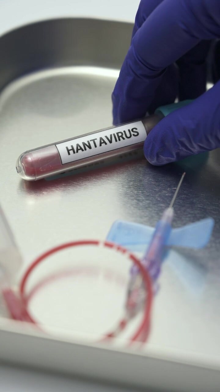 Scienziato che maneggia un campione di sangue di hantavirus in un ambiente di laboratorio per la ricerca medica