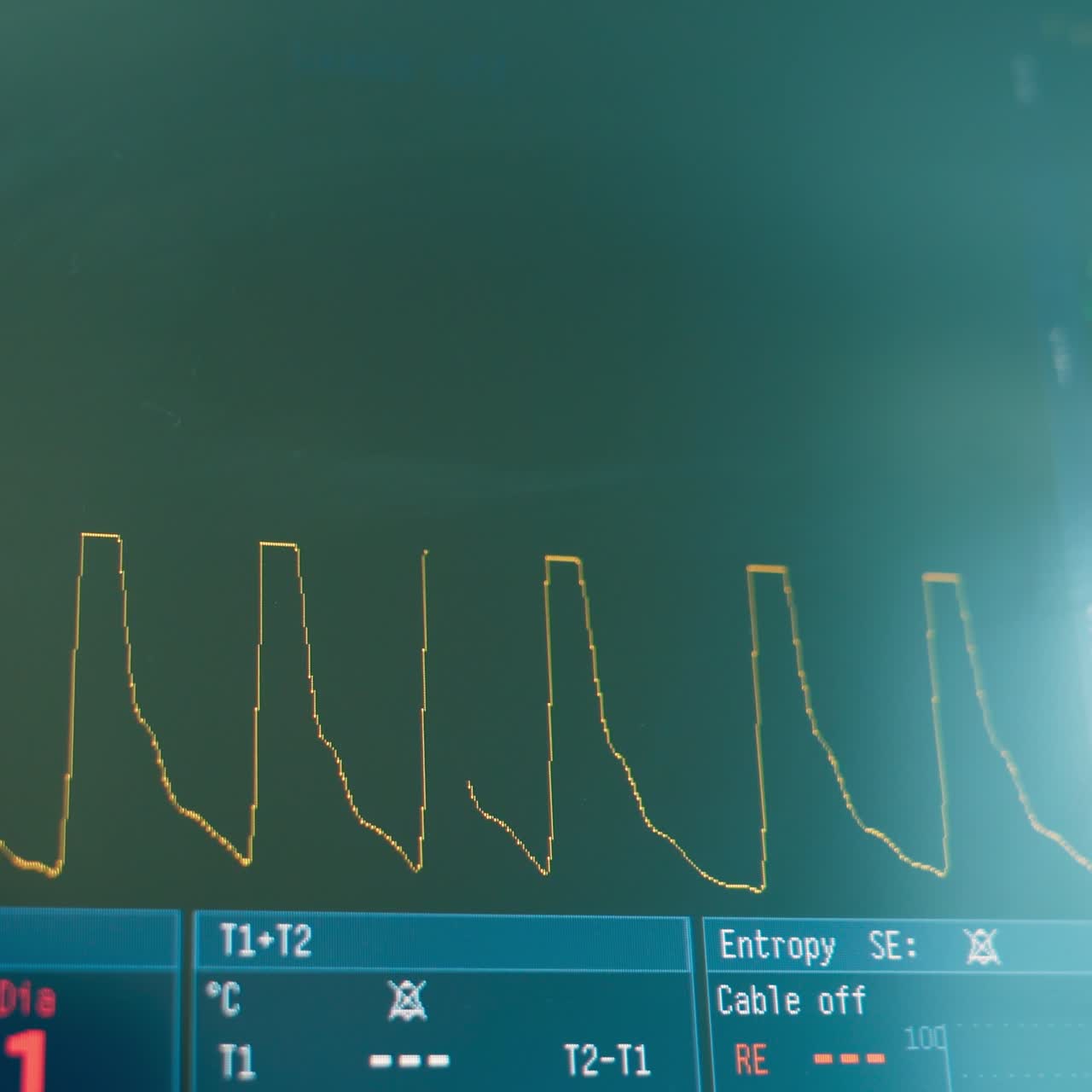Curved line moving on the screen of modern equipment in surgery room. Screen working during operation showing life parameters