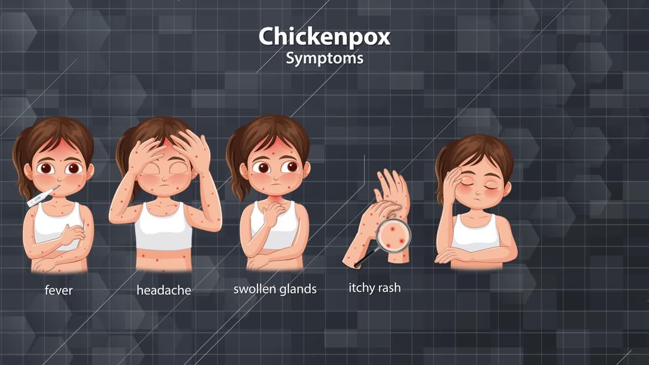 Cartoon girl demonstrates chickenpox symptoms with labeled icons, clear transitions, and neutral background