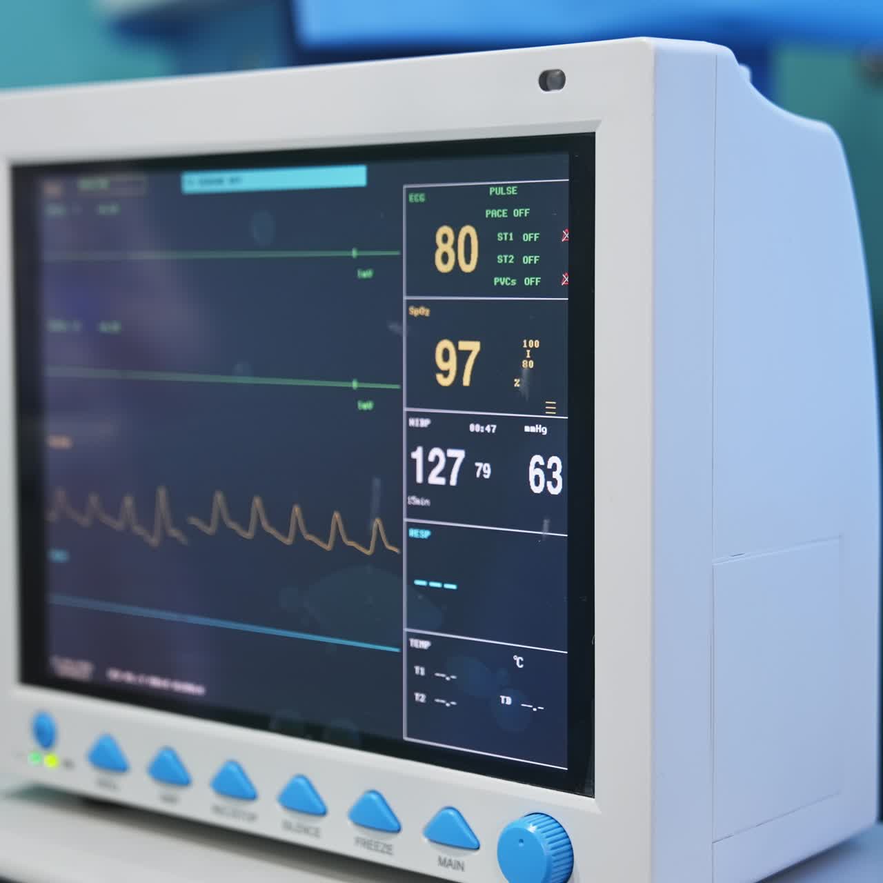 Attrezzatura nella sala operatoria in funzione durante l'operazione. Schermo che mostra i cambiamenti nei parametri vitali durante il processo di invasione