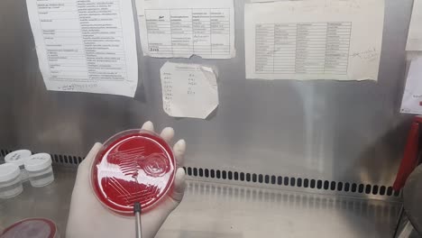 inoculation of sample in a blood agar culture plate by an inoculation loop.