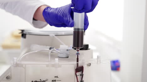 hands in blue latex gloves putting blood from a large syringe into the centrifuge device. preparation for separating plasma from blood. close up.