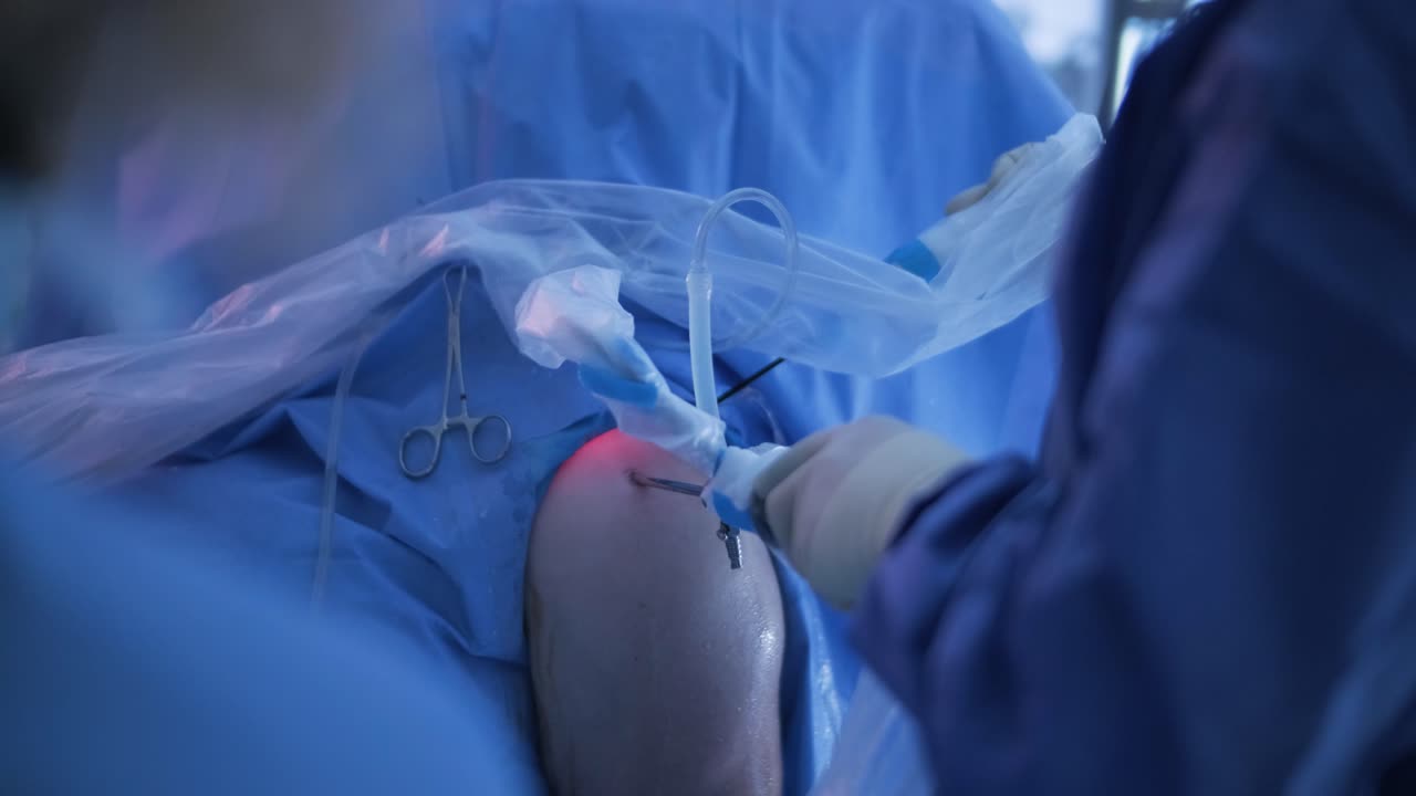 artroscopia de la articulación del hombro