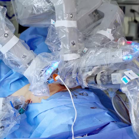 medical robotic surgical arm. medical robot operation involving performing surgery in operating room