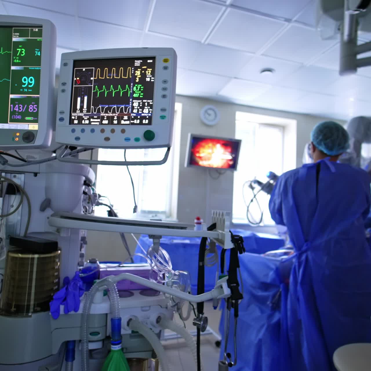 Advance equipment in modern surgery room. Surgeons cooperate with robotic surgery system. Doctor sees the process at the screen
