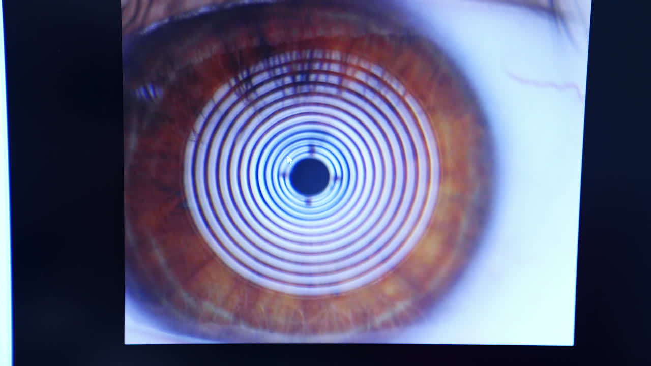 Eye of a patient on screen. Enlarged eyeball on a professional ophthalmology equipment. Close-up.