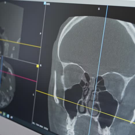 scientist scanning brain of patients