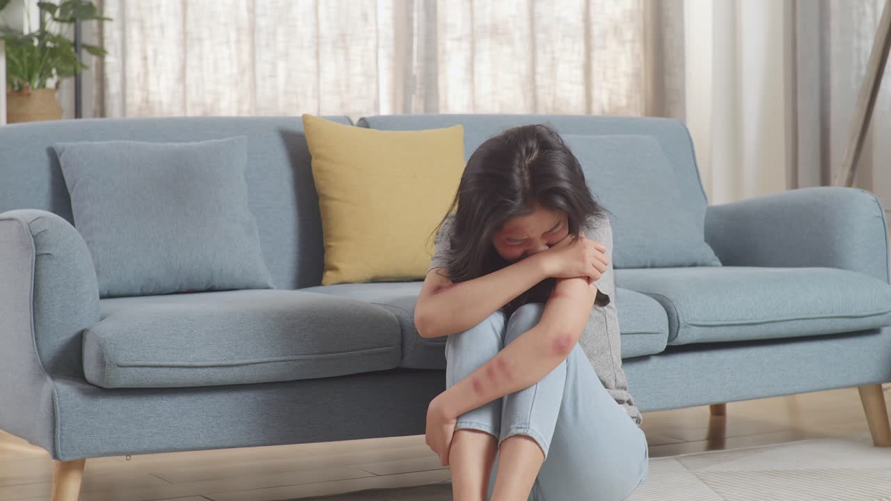 Young Asian Woman Victim Of Violence With Bruise On Body Crying Being Hurt From Physically Abused While Sitting On The Floor At Home
