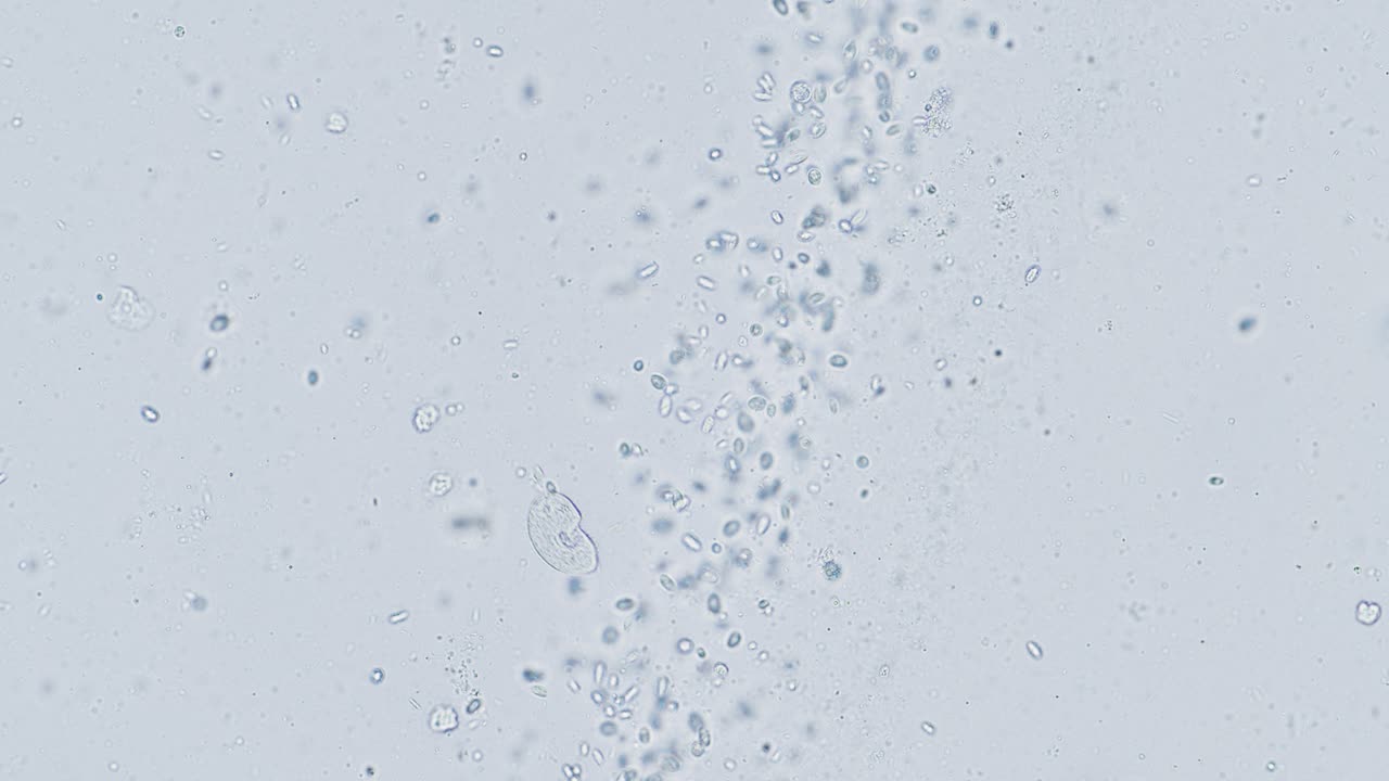 Paramecium and other single-cell organisms under microscope bright field view