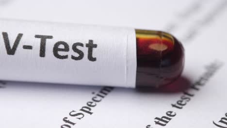 hiv test sample