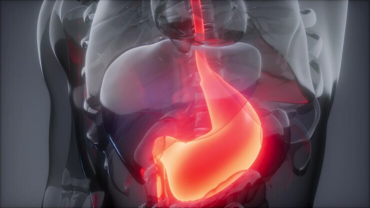 Human Stomach Radiology Exam