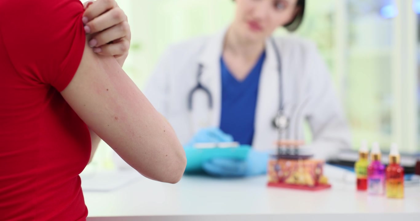 Una donna si gratta la pelle pruriginosa mentre il medico analizza lo sviluppo della malattia.