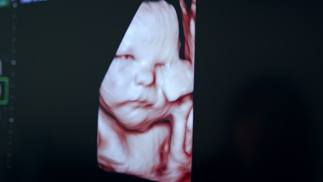 3D Ultrasound Image of a Fetus