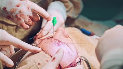 surgery team operating