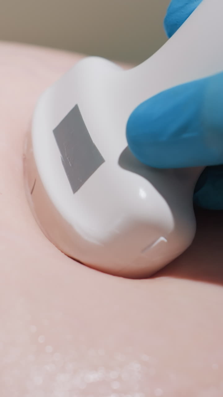 Primer plano de una sonda de ultrasonido abdominal sobre la piel que muestra la técnica del ecografista; mano enguantada aplicando gel y escena de presión constante que transmite precisión clínica con un técnico ajustando el transductor y una enfermera