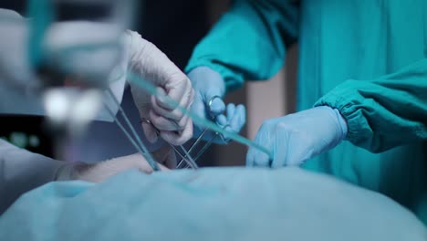 Surgeons-operating-process.-Surgeons-hands-working-with-instruments