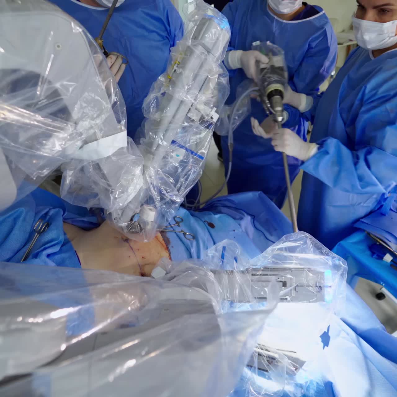 Robotic operation for neurosurgery. Medical robot operation involving performing surgery
