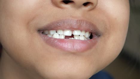 child with missing tooth