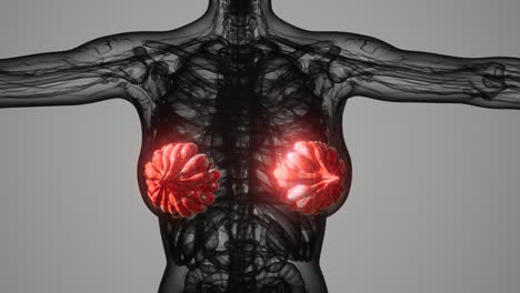 exploración médica del cáncer de mama de la mujer