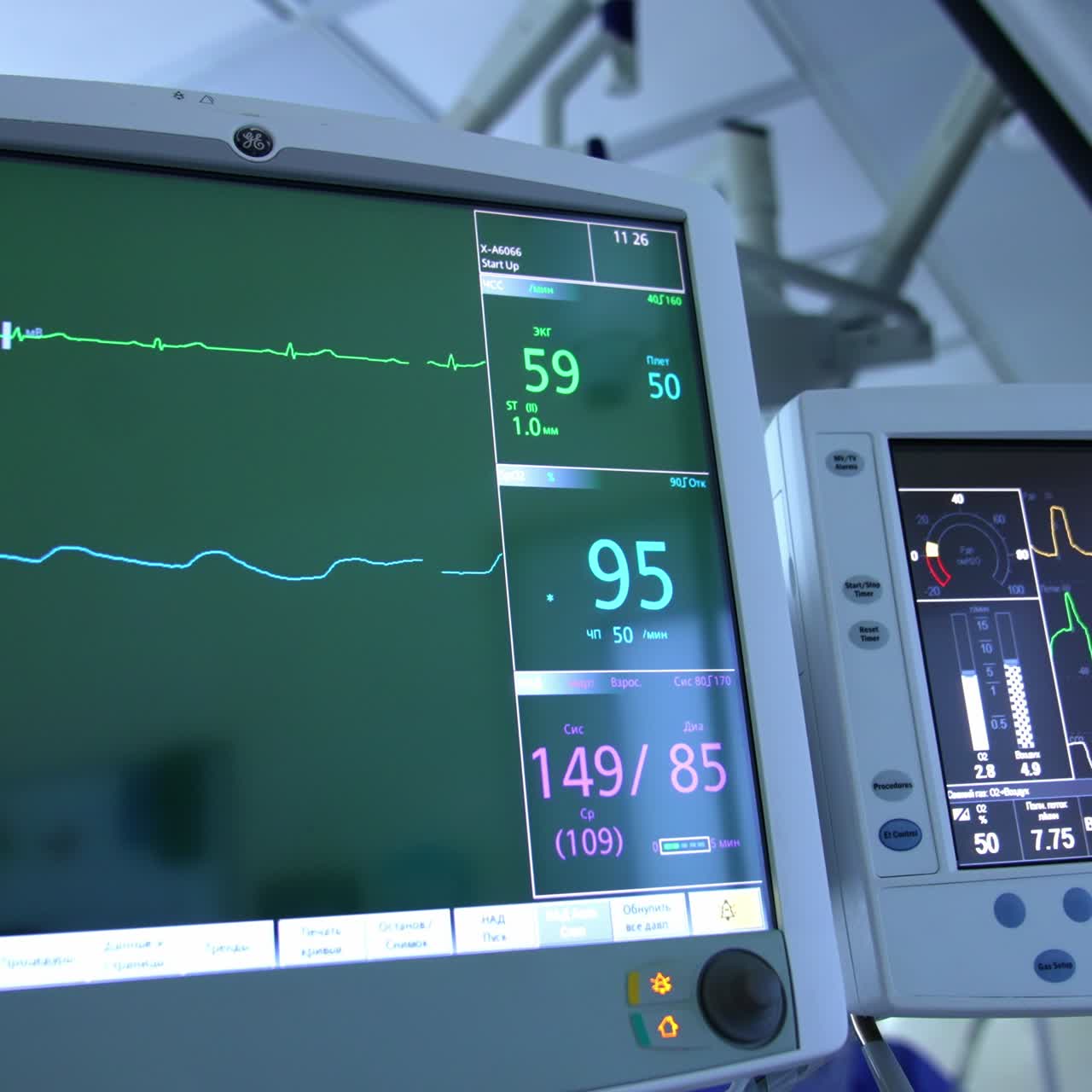 Bigger and smaller screen switched on in the modern surgery room at operation. Close up. Life curves running at monitor