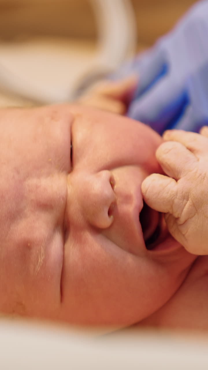 Crying newborn baby on the table. Medic in latex gloves attaches the wire to a child's hand. Close up. Vertical video