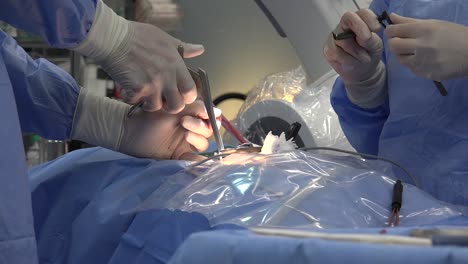 las cirugías mínimamente invasivas abarcan técnicas quirúrgicas que limitan el tamaño de las incisiones necesarias y, por lo tanto, disminuyen el tiempo de cicatrización de heridas, el dolor asociado y el riesgo de infección.
