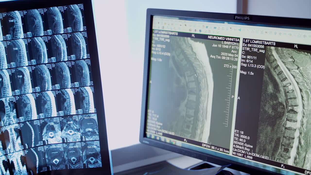 Doctor holding x ray. Close up of doctor holding x-ray