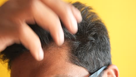 man checking his hair loss