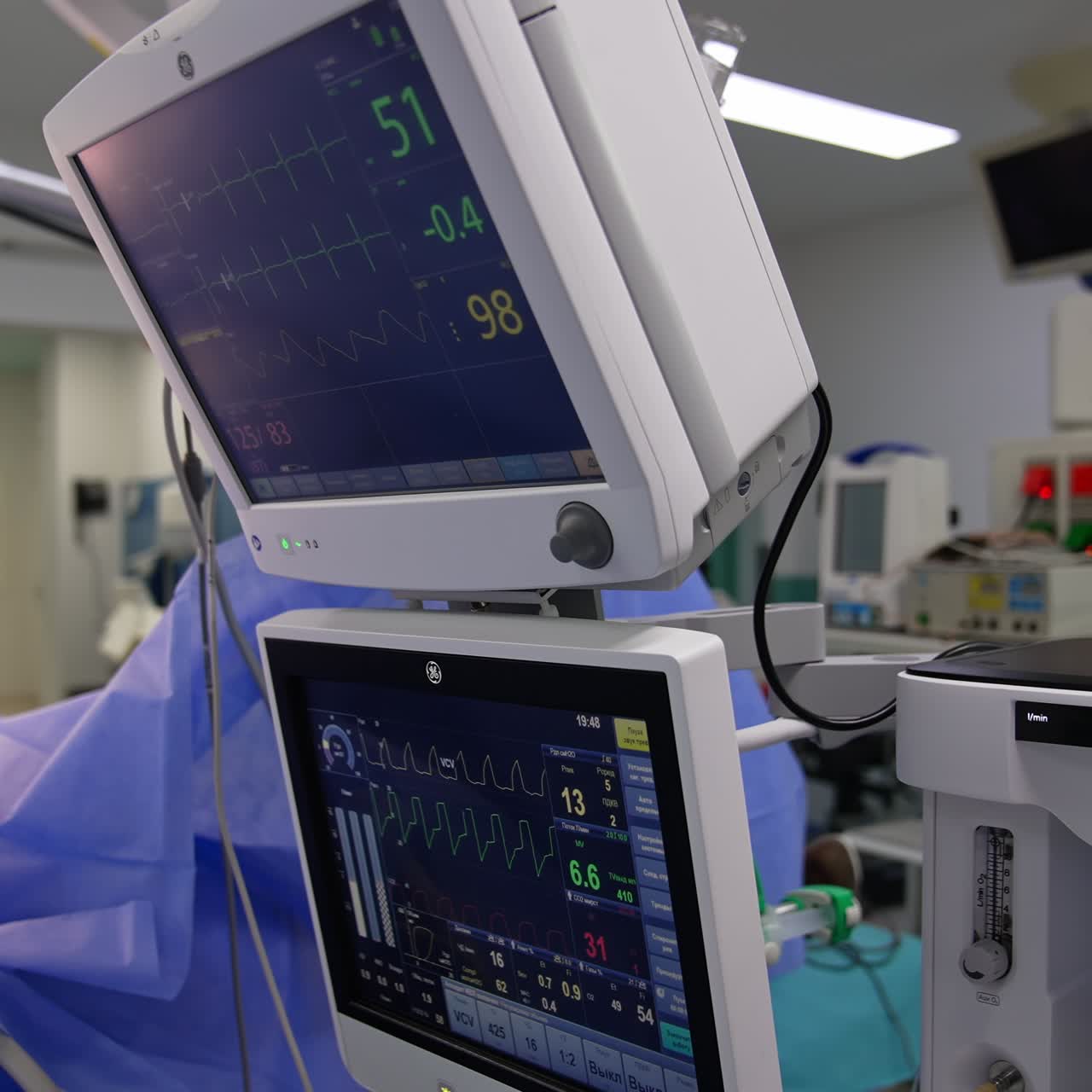Diversi parametri di un paziente sotto i ferri. Due schermi in funzione nella sala operatoria. Un team di medici esegue l'operazione accanto ai monitor.