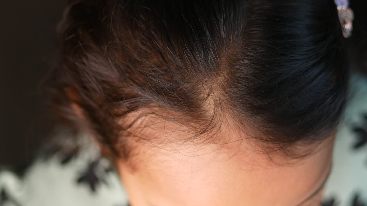 여성의 머리카락의 근접