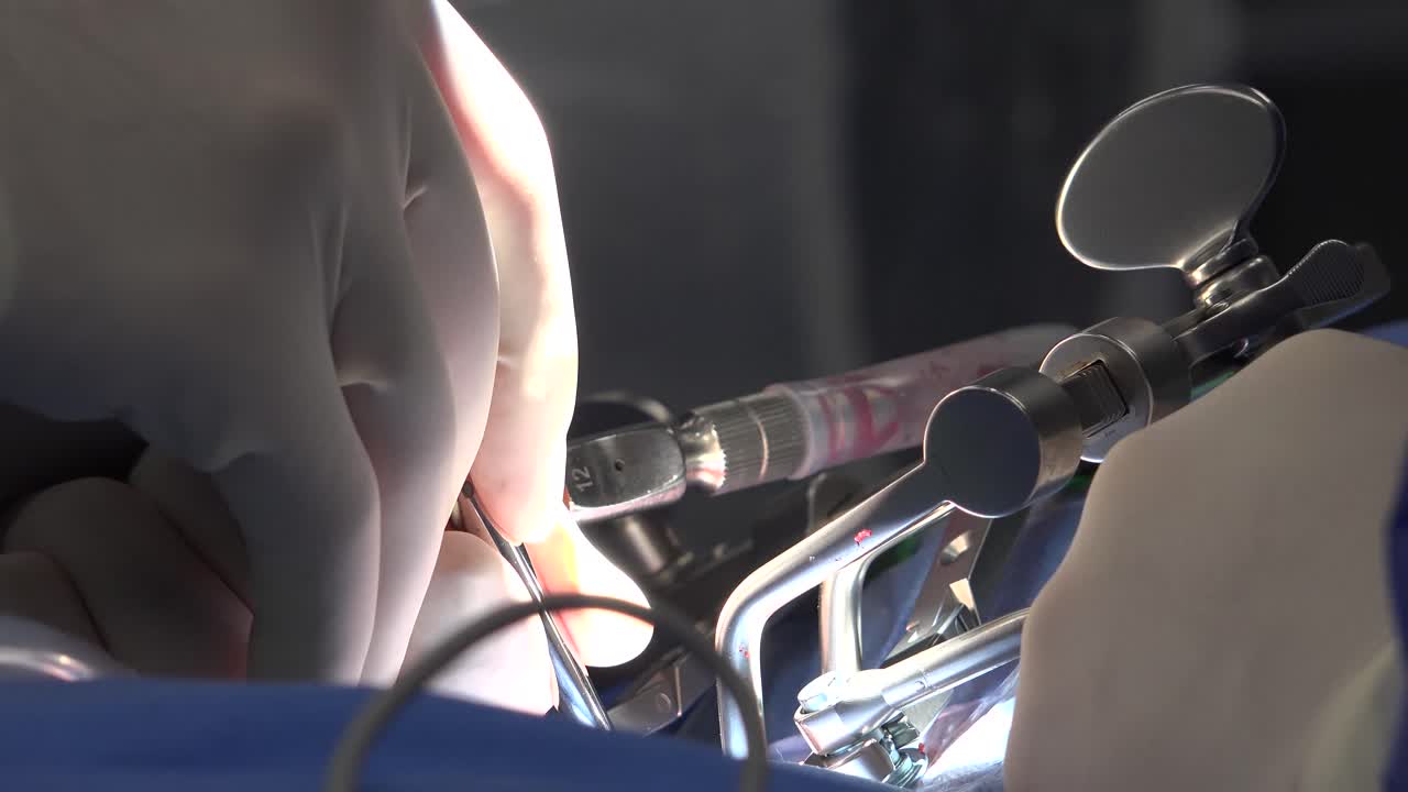 Spine Surgery Explained: Common Procedures, Recovery Expectations, Risks, and Advances in Minimally Invasive Techniques for Treating Chronic Back Pain and Spinal Disorders"