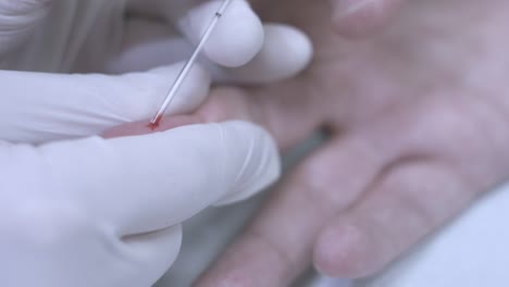 draw blood finger. finger blood test sample. finger blood draw