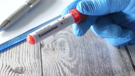 coronavirus blood sample test