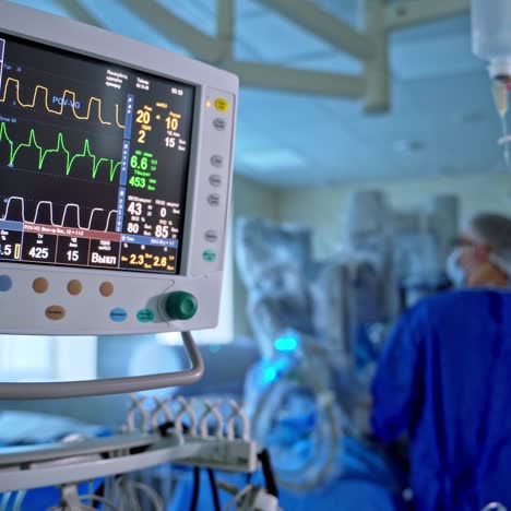 medical monitor in the hospital. modern equipment in the operating room on the background of doctors in blue uniform. screen displays patient's vital signs.
