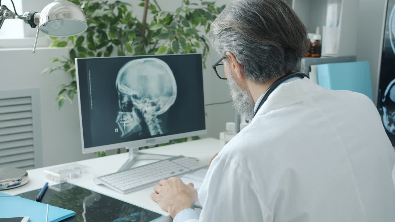 Doctor reviewing skull X-ray