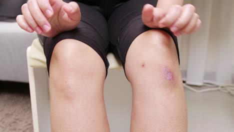 woman having knee pain the concept of preventing leg fatigue and self-massage