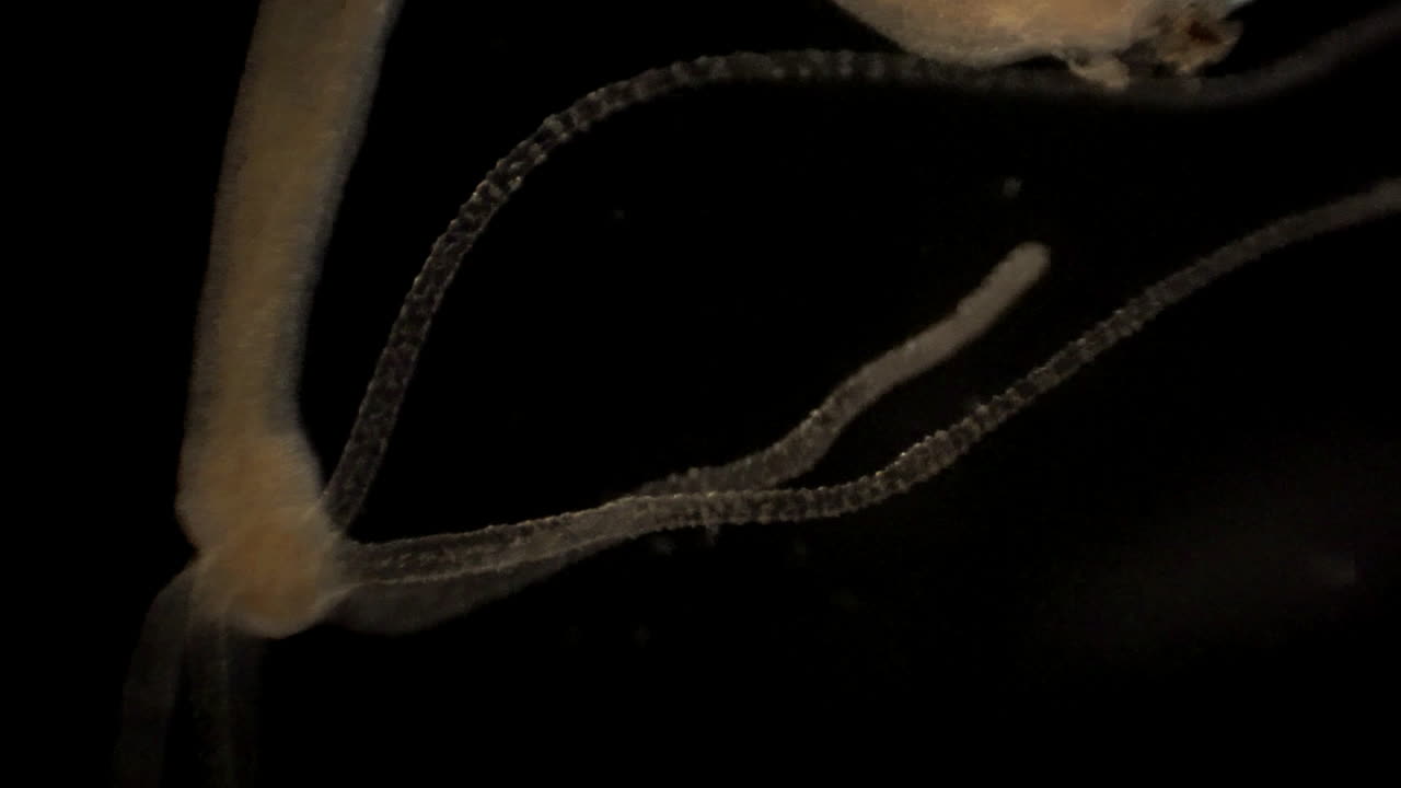 imágenes microscópicas de hidra