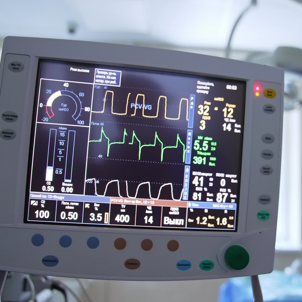 Numbers and lines describing diverse vital parameters of operated patient. Close up with gradual distancing from monitor
