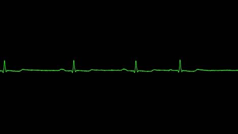 el ecg muestra bradicardia sinusal