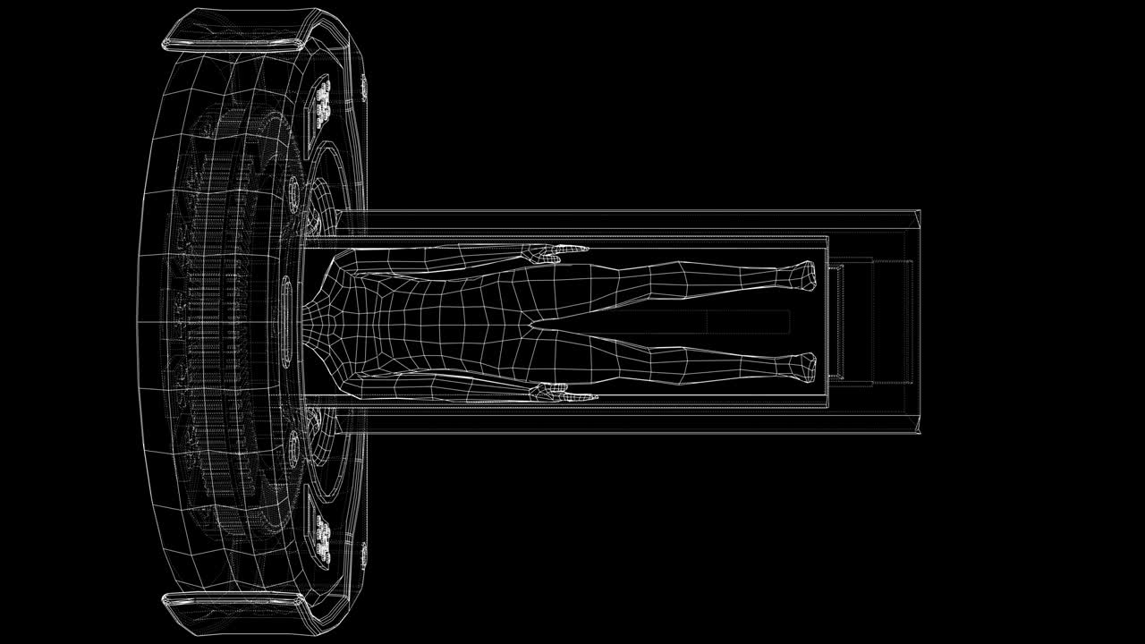 mri, 자기 공명 영상 기계, 환자 내부 스캔